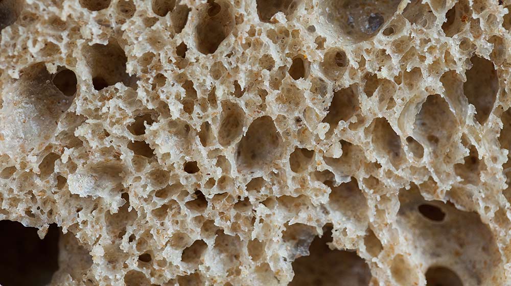 what is coeliac disease?